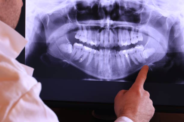 Best Emergency Dental Care for Broken or Chipped Teeth in Parker, SC