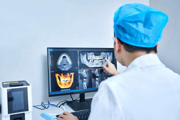 Best Emergency Root Canal Treatment in Parker, SC