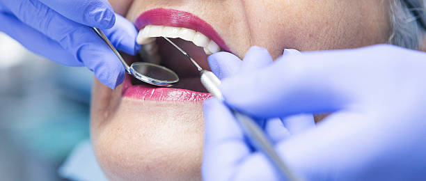 Best Emergency Gum Treatment in Parker, SC