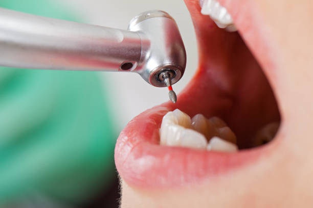 Best After-Hours Dental Trauma Care in Parker, SC